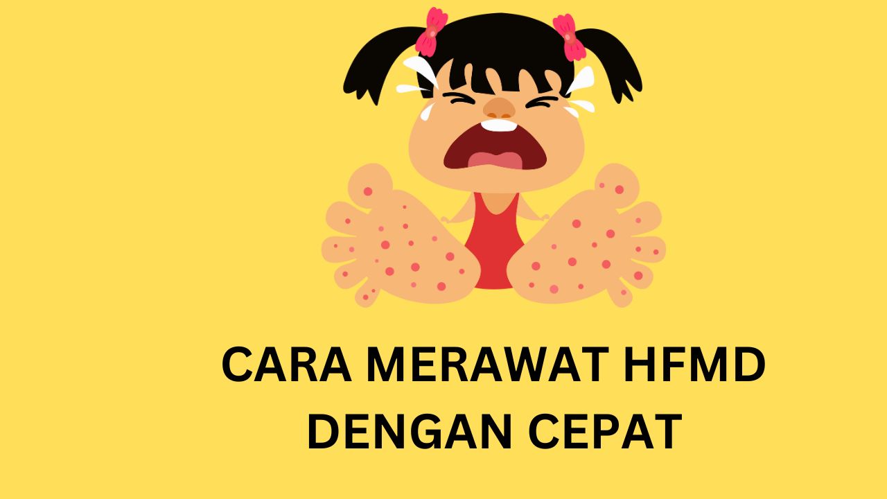 CARA MERAWAT HFMD